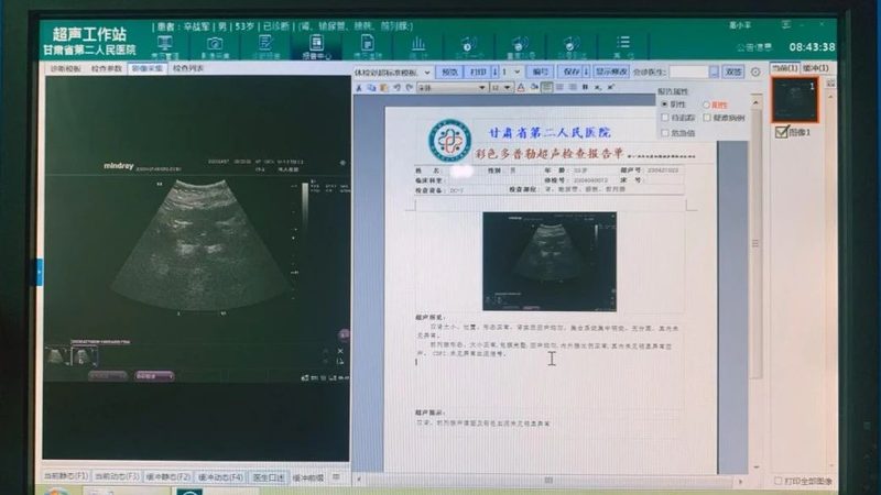 成都慢病管理软件：守护健康，科技助力精准管理